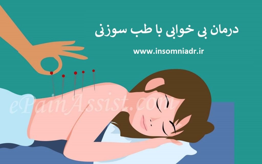 دکتر درمان بی خوابی